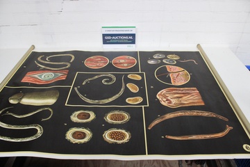 Afbeelding van Vintage Anatomische Kaart over Darm Parasieten